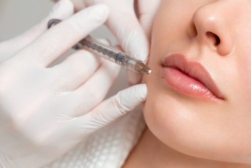 A woman makes lip shape correction in a cosmetology clinic. Lips injections, lip augmentation