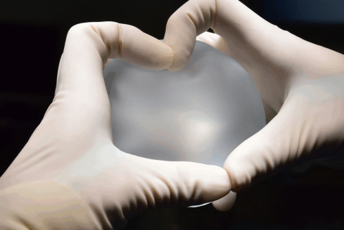 photo-1644613569194-bd66cf476414