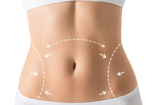 tummy-tuck-treatments-inner